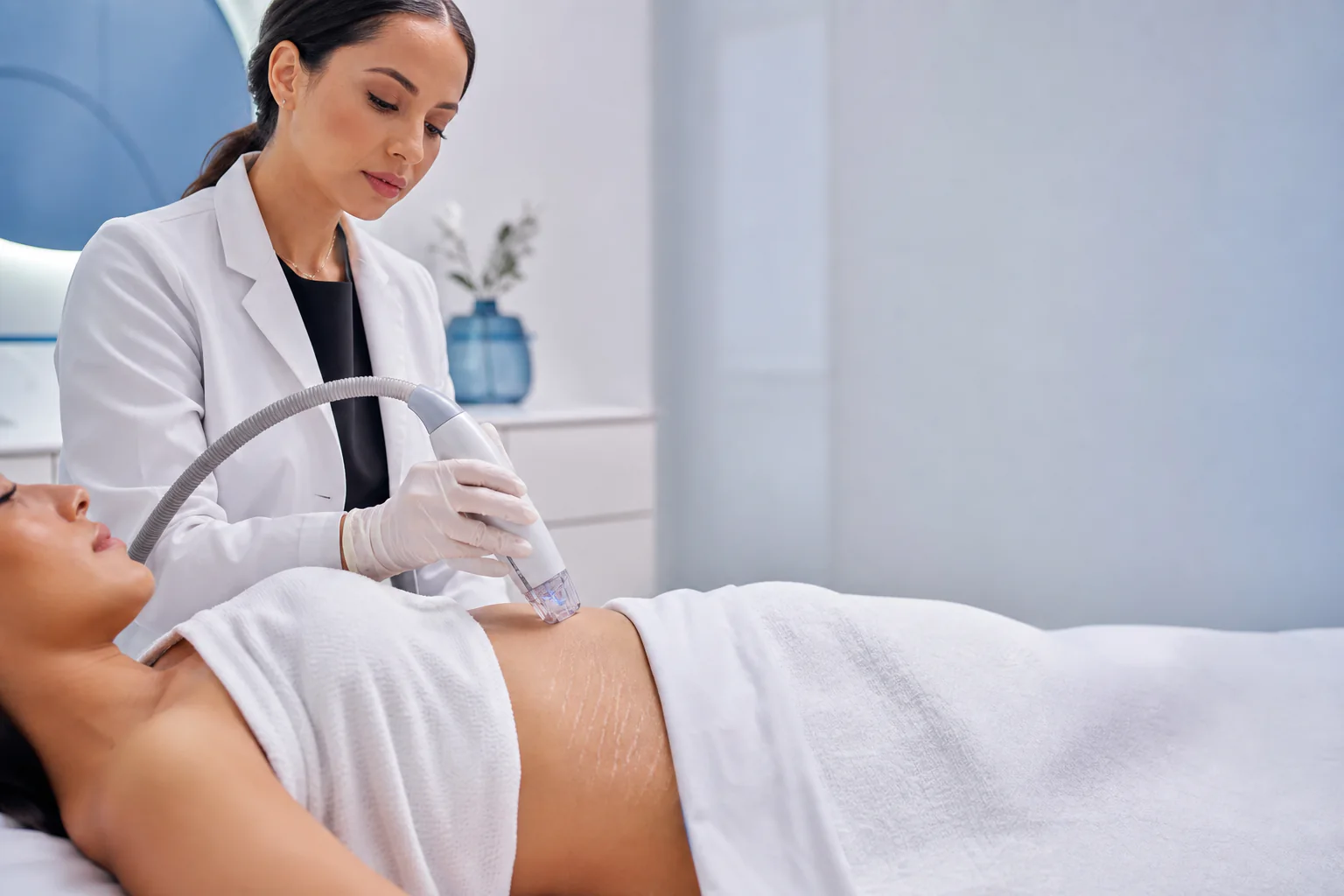 Stretch Marks Treatment treatment in Ras Al Khaimah